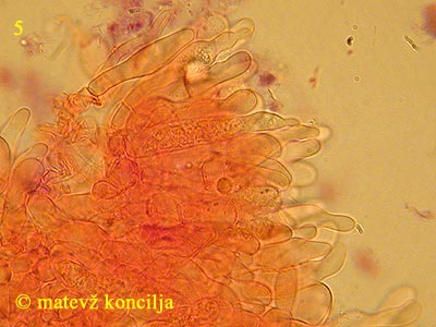 Russula acrifolia - cistide