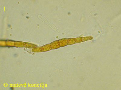 Leptosphaeria acuta - Sporen