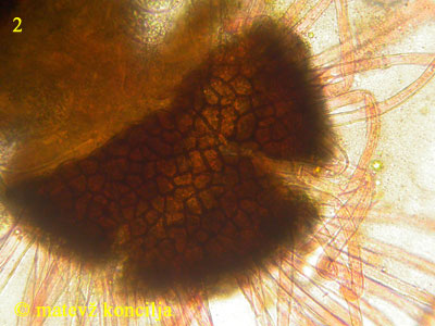 Erysiphe adunca - Excipulum, Anhängsel