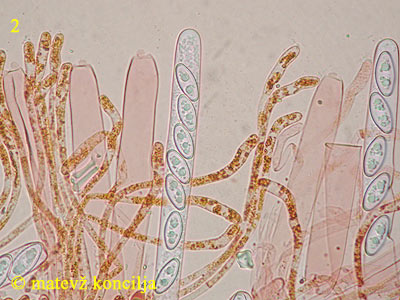 Byssonectria aggregata - Asci