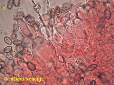 agrocybe species - Pleurozystide