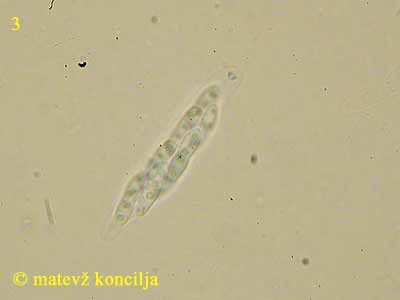 Diaporthe sp. - Ascus