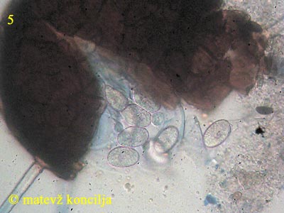 Erysiphe alphitoides - Cleistothecium