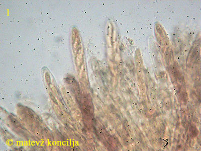 Mollisia amenticola - Asci