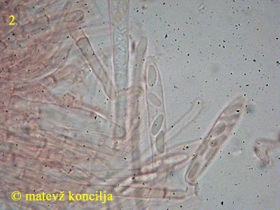 Mollisia amenticola - Sporen