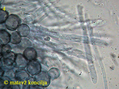Mollisia amenticola - Excipulum