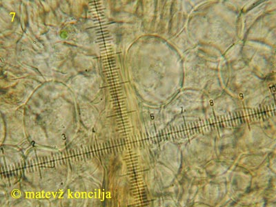 Arcyria cinerea - ciste v betu