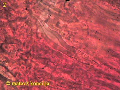 amylostereum areolatum - skeletocistide