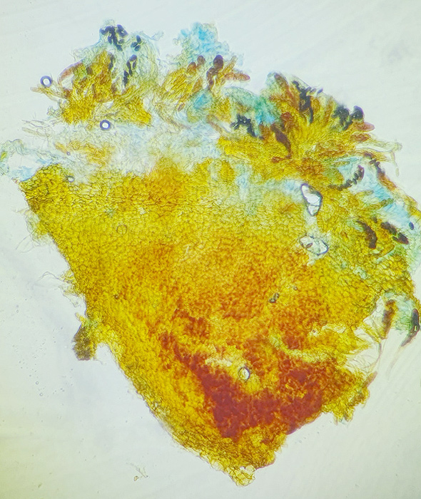 Ascobolus sacchariferus