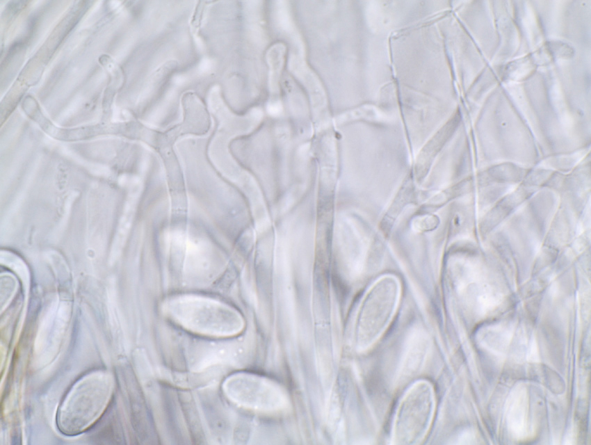 Ascobolus sacchariferus