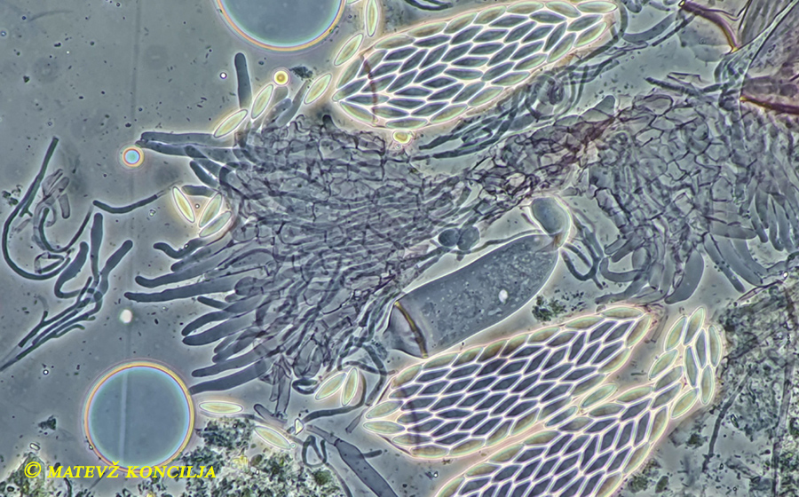Ascozonus woolhopensis