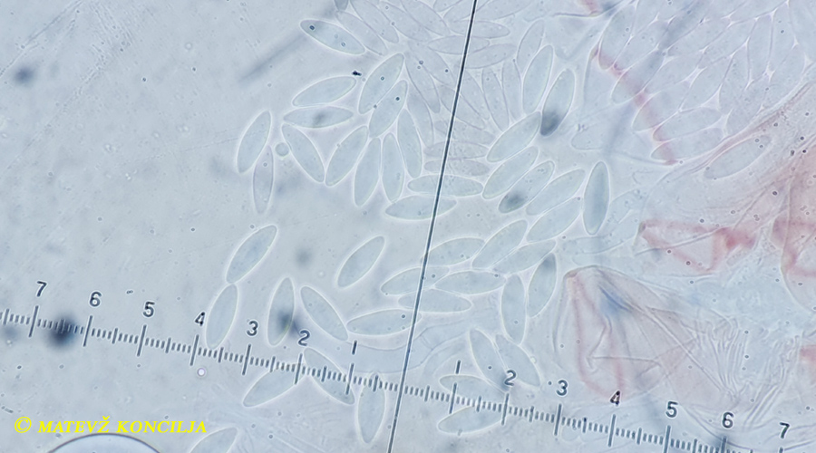 Ascozonus woolhopensis