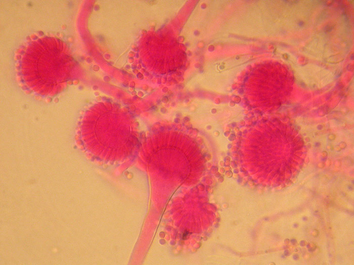 Aspergillus fumigatus