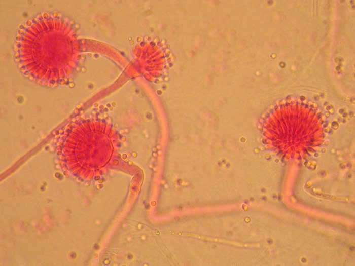 Aspergillus fumigatus