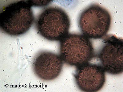 elaphomyces asperulus - trosi