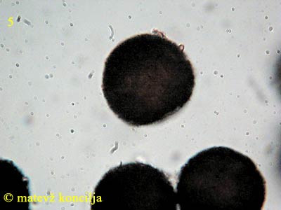 Elaphomyces asperulus - Sporen