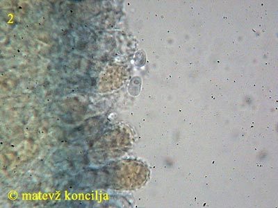 Mycena aurantiomarginata - Cheilozystiden