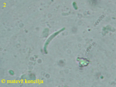 Orbilia aurantiorubra - tros