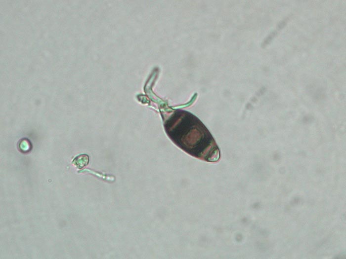 Bactrodesmium betulicola