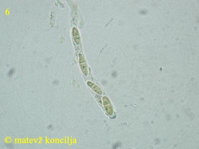 Mollisia benesuada - Ascus