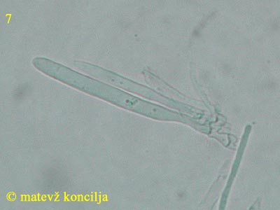 Mollisia benesuada - Ascus