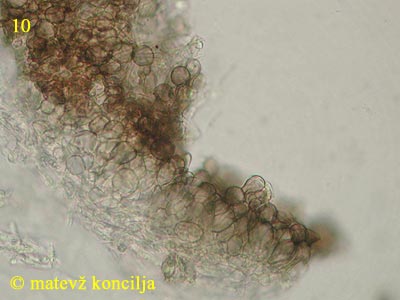 Mollisia benesuada - Excipulum