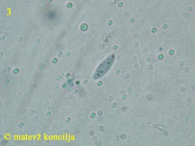 Mollisia benesuada - Sporen