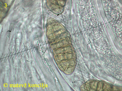 Cucurbitaria berberidis - trosi