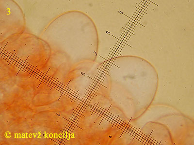 Coprinellus bisporus - kajlocistide