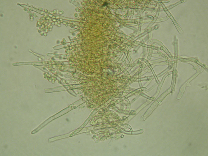 Amphinema byssoides - cistide