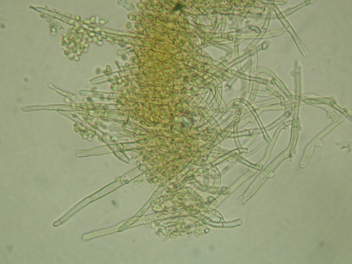 Amphinema byssoides - Fransiger Wollrindenpilz/Zystiden