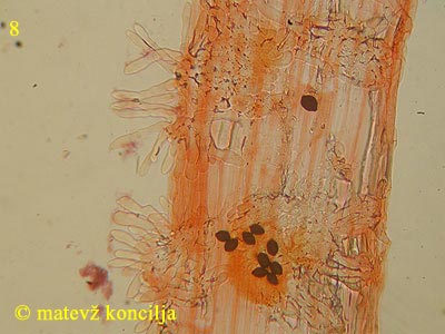 Panaeolus papilionaceus var. capitatocystis - Kaulozystiden