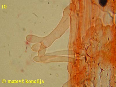 Panaeolus papilionaceus var. capitatocystis - Kaulozystiden