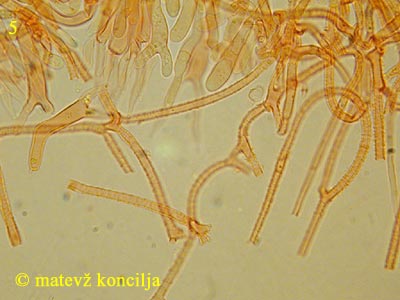 Dacrymyces capitatus - Basidien