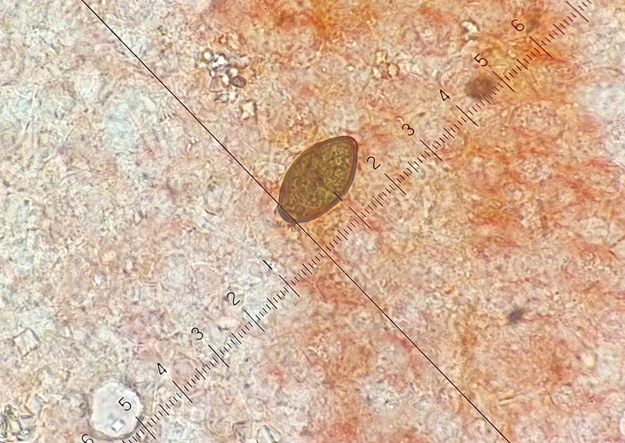 Cercophora brevifila
