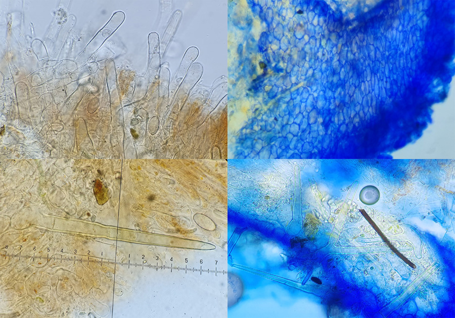 Cheilymenia crucipila - Sternhaariger Schildborstling