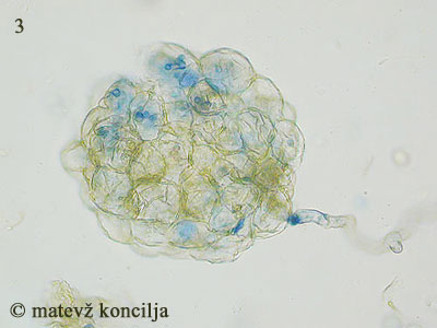 Eurotium herbariorum - Chleistothecium