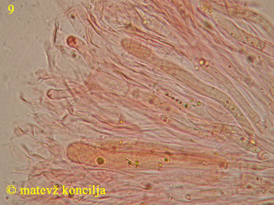 Dacrymyces chrysospermus - Basidiolen/Hyphidien