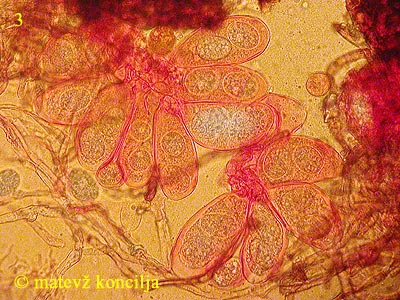 Erysiphe cichoracearum - Asci