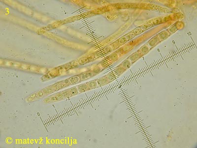 hypocrea citrina - aski