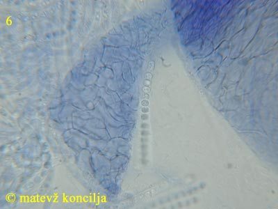 Hypocrea citrina - excipulum