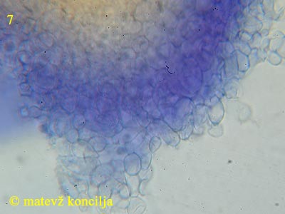 Hypocrea citrina - stroma