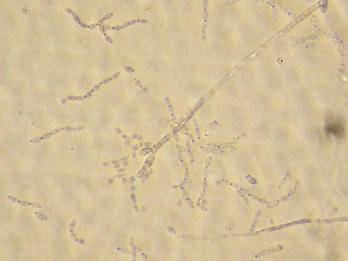 Cladosporium tenuissimum