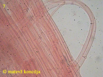 galerina clavata - hife beta