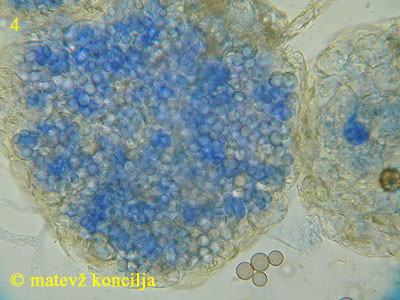 Eurotium herbariorum - Chleistothecium