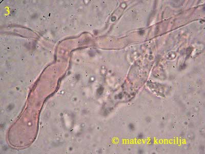 vuilleminia comedens - bazidij