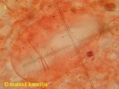 Coprinopsis cinerea - Pleurozystide