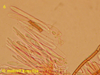 Lasiobelonium variegatum - Asci