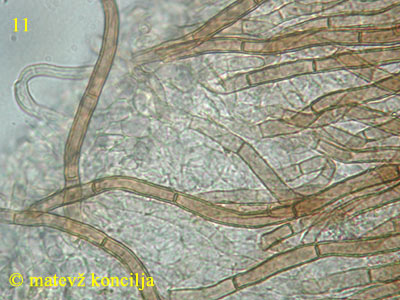 Lasiobelonium variegatum - Haare