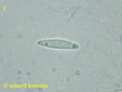 Lasiobelonium variegatum - askospore